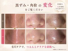 フロラスキン 梅田店(florasKIN)