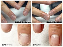 ネイルメン(NAIL MEN)