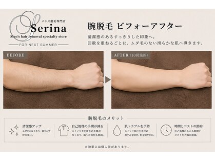 セリナ(SERINA)の写真