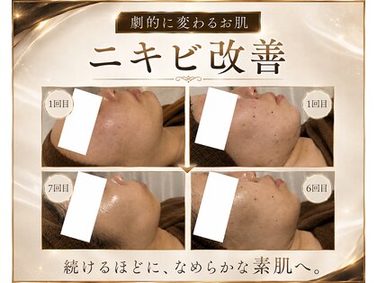 ベル みどりの店(belle)の写真