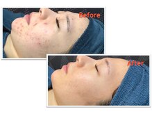 SNSで人気のデザインもお任せ☆