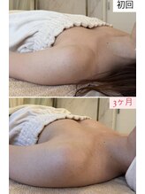 ラビス(RAVIS)/3ヶ月でサイズアップ！