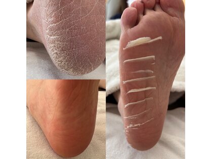 アウリイ(aulii)の写真