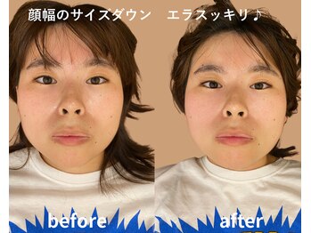 リファイン整体院 国分寺店/小顔、骨盤、ヘッドスパ、整体