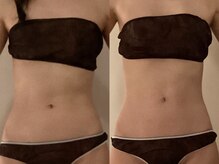 ミオン(美温)/よもぎ蒸し×腸もみ