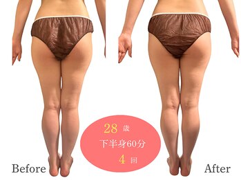 アルピナ(ALPINA)/ウルトランスフォーマー