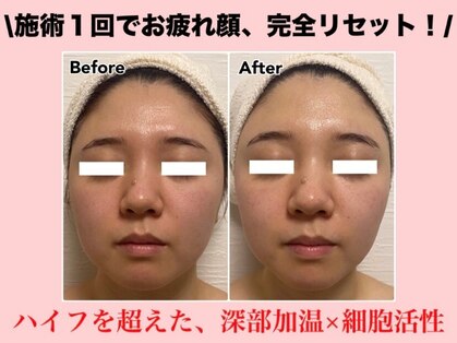 エステティックサロン みなとやの写真