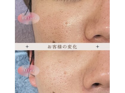 ラ メール ヴィーヴルの写真