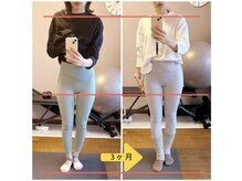 ポノフィット(PONO FIT.)/症例／ヒップ（脚長）