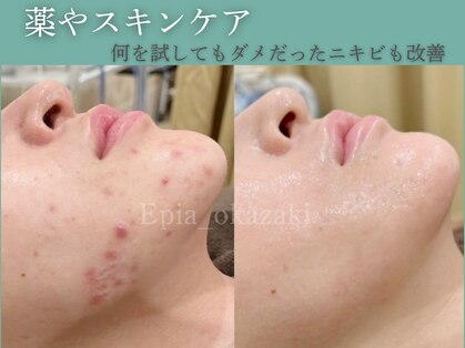 エピア 岡崎店(Epia)の写真