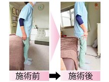 サナ 浜松/猫背改善