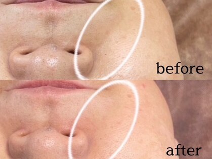 トータルビューティー雅の写真