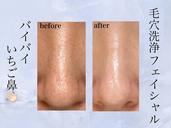 ミュー(professional beauty salon MYU)/黒毛穴ケアはお任せください!