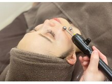 ハリルル 併設 GLケンタ鍼灸整骨院(HARILULU)/Vスティック　【リフトアップ】