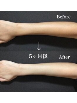 ザモア 福岡天神(THE MORE)/ホワイトシャイン【全身美白】