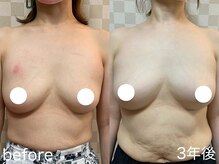 ハレオラ(HaleOla)/40代☆ブラをご愛用♪