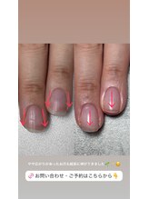 ココ(COCO)/生え方も変わってきます