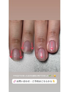 ココ(COCO)/生え方も変わってきます