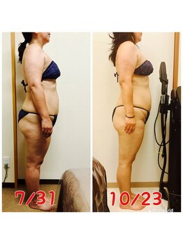 スマイルボディ つぼの森 吉野店(Smile body)/ラジオ波