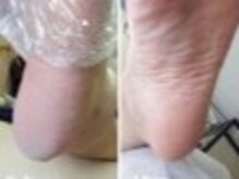 リゼラアンドコー 船橋店/ドイツ式フットケア専門店