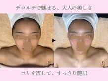 プラスワンビューティテン 新大阪店(Plus One Beauty)の雰囲気（フェイシャル施術効果：肩こり/小顔/美肌/たるみ/むくみ/くすみ）