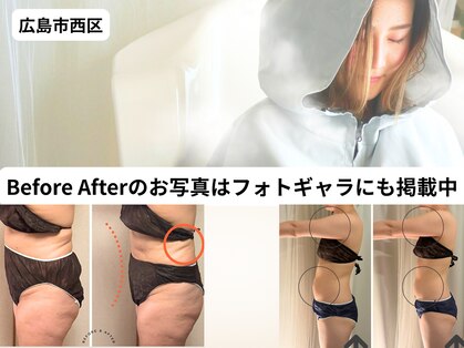 ヨサパーク シアー(YOSA PARK sheer)の写真