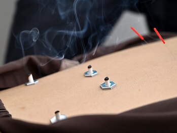 エド鍼灸院 日本橋(EDO鍼灸院)の写真/【日本橋・大手町】デスクワーク疲れに鍼灸◎首肩こり・眼精疲労を根本改善◎会社帰りにおすすめの鍼灸院