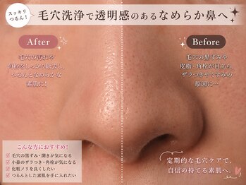 リラクシーボーテ(relaxy Beaute)の写真/毛穴洗浄で黒ずみをケアし毛穴レスな肌へ！角栓や角質のざらつきをごわつきから解放♪