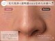 リラクシーボーテ(relaxy Beaute)の写真/毛穴洗浄で黒ずみをケアし毛穴レスな肌へ！角栓や角質のざらつきをごわつきから解放♪