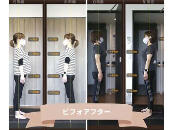 クレマティーデ(clematide)/40代女性姿勢ビフォーアフター