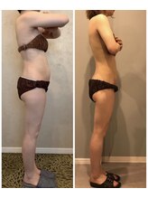 サロン ド フェイス モアナ(Salon de Faith Moana)/キャビテーション痩身