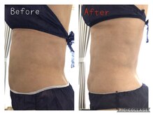 エムケーサロン(Mksalon)/60代/モニター様