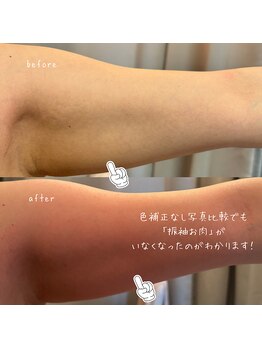 薬手名家 新宿店/二の腕を細くしたい方、必見！