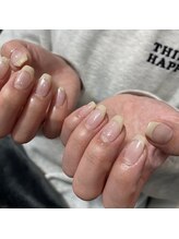 ブラックラッシュ(BLACK RUSH)/フレンチネイル4400