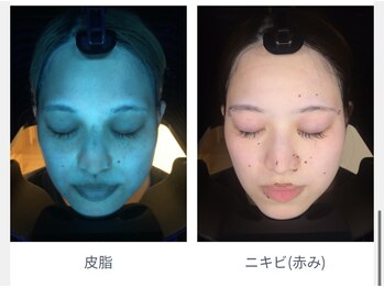 ムゥ(muu)/【肌診断機】