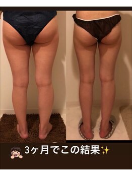 ヨサパーク ラブリエ 吉祥寺店(YOSA PARK La Briller)/むくみもスッキリ