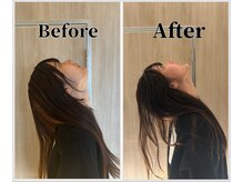 整体ラルース 中目黒(LALUZ)/20代 女性 ストレートネック改善