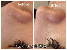 アンドエミニー エン ラボーテ(& EMINY 艶 la beaute)/フェイシャルWax