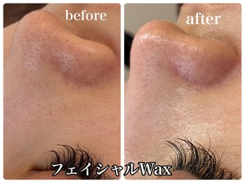 アンドエミニー エン ラボーテ(& EMINY 艶 la beaute)/フェイシャルWax
