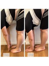 コハク(kohaku)/ビフォーアフター!(^^)!