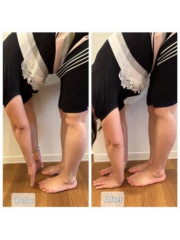 コハク(kohaku)/ビフォーアフター!(^^)!