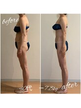 ヘルス＆ビューティークリニック　住美香（すみか）/骨格から痩せるFTIコース！