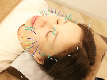 ウル鍼灸整骨院/【プレミアム美容鍼】