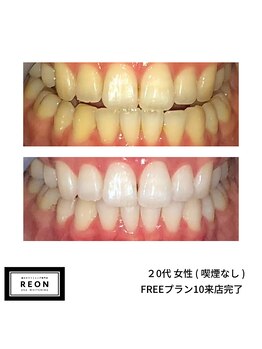 レオン 磐田(REON)/◇ お客様 before＆after ◇