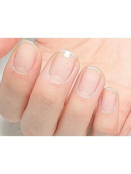 爪の悩みを解消できる（ケア含む）