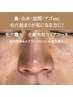 頑固な黒ずみ撃退！【毛穴職人全顔角栓クリアコース】エクストラクション付