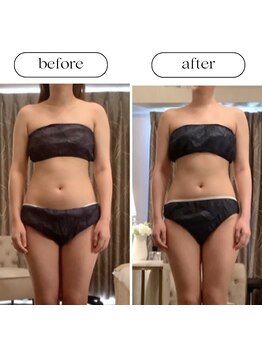 スラン(Slan)/全身引き締め360°美ボディ