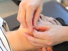 すみ治療院の雰囲気（極細鍼で肌の内側へ刺激！ハリ・たるみ改善をサポート。）