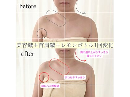 アキュモンド 渋谷院(acumond)の写真