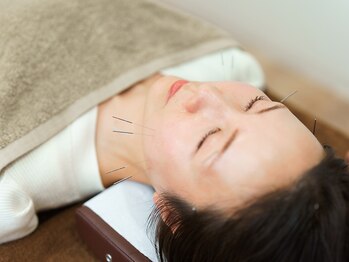 たたら鍼灸整骨院の写真/【美容鍼が初めての方にも◎】小顔×肌質改善×健康体が叶う☆幅広いお悩みに効果的な“美容鍼”が大人気！